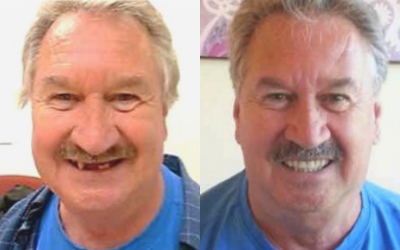 Adopt a Vet Dental Program Before and After David LaFrase