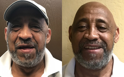 Adopt a Vet Dental Program Before and After Rufus Griggs