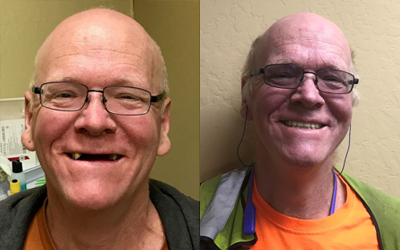 Adopt a Vet Dental Program Before and After Todd Tunstall
